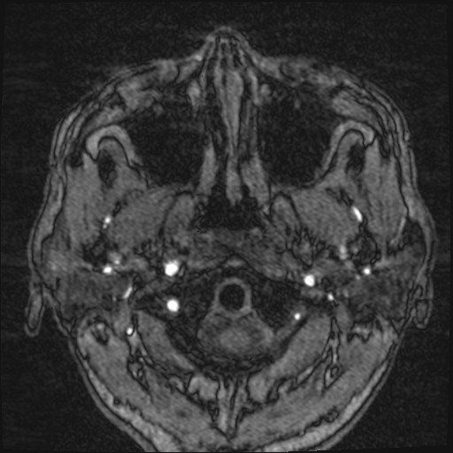 Click on the Serie image to view the images of VILLANUEVA, WILLIAM A.